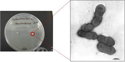 ▲ 국내 토착 메탄생성 고세균(Methanobrevibacter hanwooensis JH1)  전자현미경 사진.