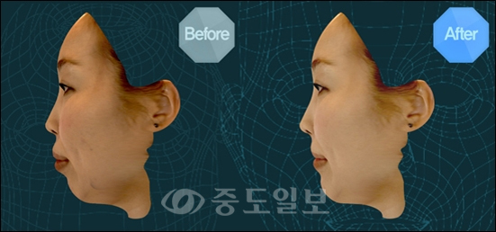▲ 사진=투명치과 홈페이지