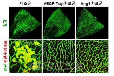 망막병증 생쥐 모델에서의 안구 내 투여한 안지오포이에틴-1(Angiopoietin-1)의 역할.