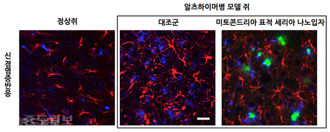 ▲ 미토콘드리아 표적 산화세륨 나노입자가 알츠하이머병 모델 생쥐에서 나타나는 신경염증반응에 미치는 영향.
<br />알츠하이머병 모델 생쥐의 뇌에서는 성상세포(붉은색)와 소교세포(파란색)가 늘어나 신경염증반응이 증가한다. 하지만 미토콘드리아 표적 산화세륨 나노입자(초록색)를 뇌에 주입한 경우 신경염증반응이 감소된 것을 알 수 있다.(제공= 기초과학연구원)