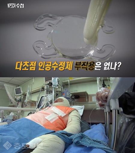 ▲  /MBC PD수첩 홈페이지 제공.