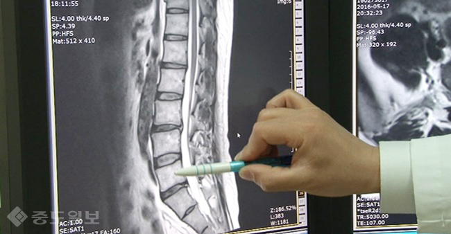 ▲  /KBS 1TV  ‘생로병사의 비밀’ 제공