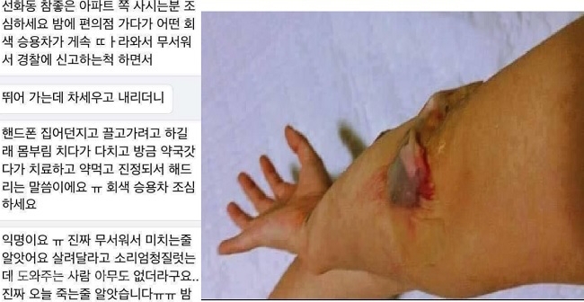 ▲ 지난 11일 페이스북 한 페이지에 납지도중 간신히 도망친 남자의 몸 상처라며 제보 글과 사진이 추가됐다. 