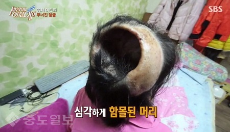 ▲ '세상에 이런 일이' 화면 캡쳐