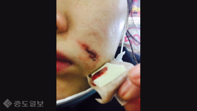 ▲ 사진='궁금한 이야기 Y' 예고 ▲ 사진='궁금한 이야기 Y' 예고