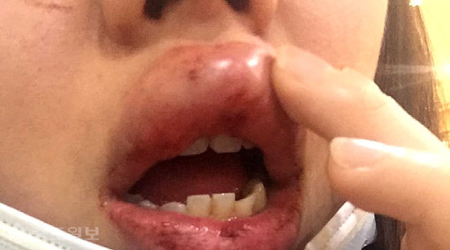 ▲ 사진='궁금한 이야기 Y' 예고 ▲ 사진='궁금한 이야기 Y' 예고