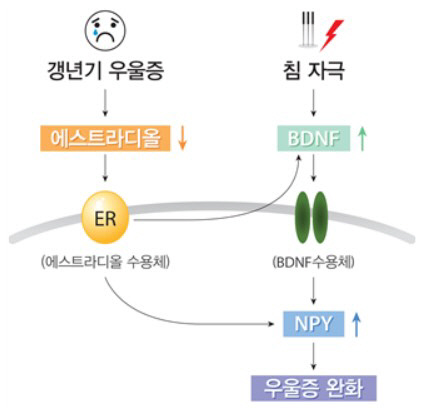 갱년기우울증