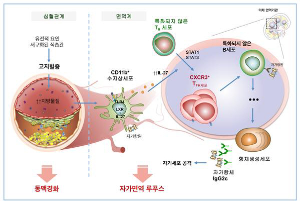 고지혈증