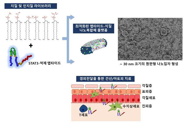 카이스트 건선