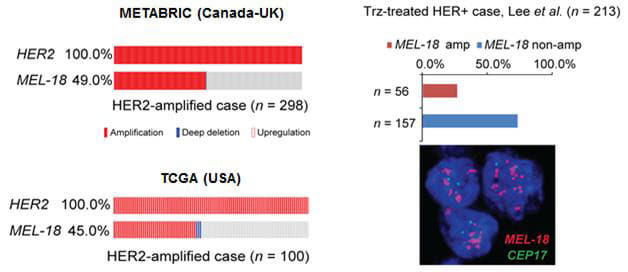 HER2 양성 유방암에서 MEL-18의 유전적 변이