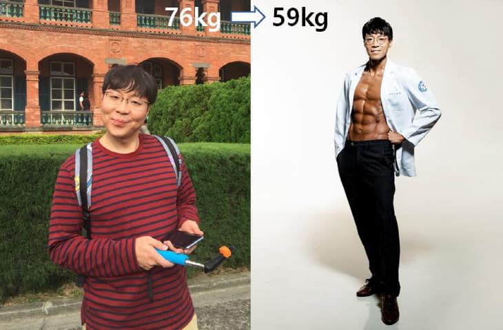정태 전후 비교 004