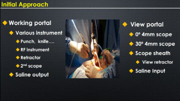 웹 캡처_5-3-2023_12812_amplifysurgical.com