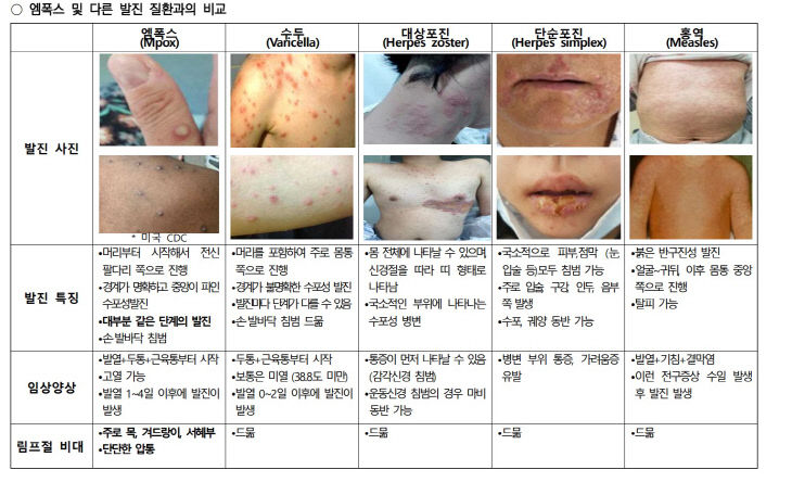 엠폭스 및 다른 발진과 비교