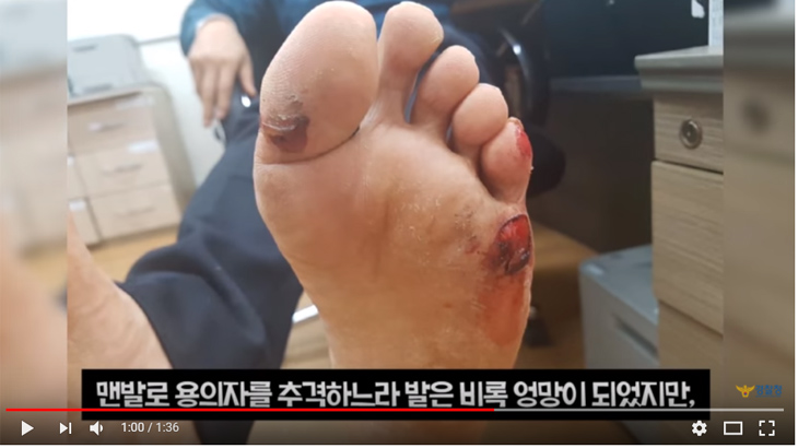 맨발로 3km달려 범인잡은 경찰관! 발은 만신창이