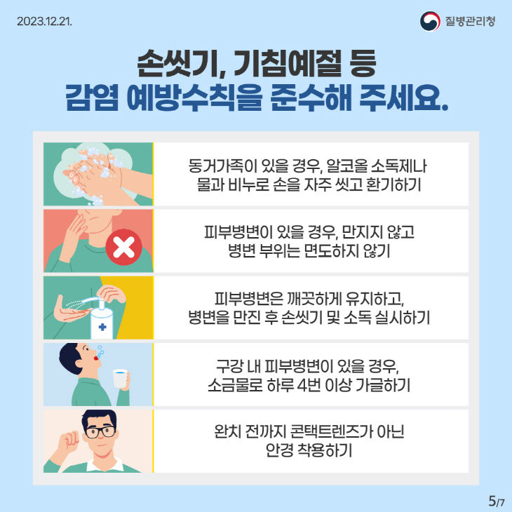 7. 고양시, 엠폭스 예방위해 개인방역수칙 준수 당부